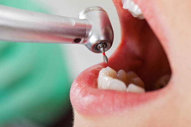 Best Weekend Emergency Dentist in Rancho Cordova, CA